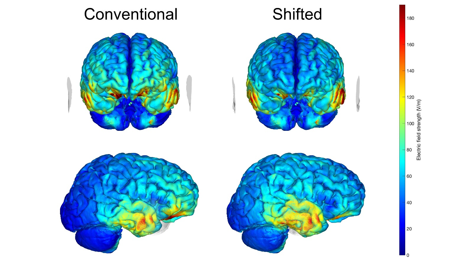 3D FEM simulations performed to compare the two electrode placements