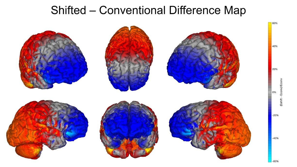 Postprocessing of FEM simulations to visualize different electric field distributions