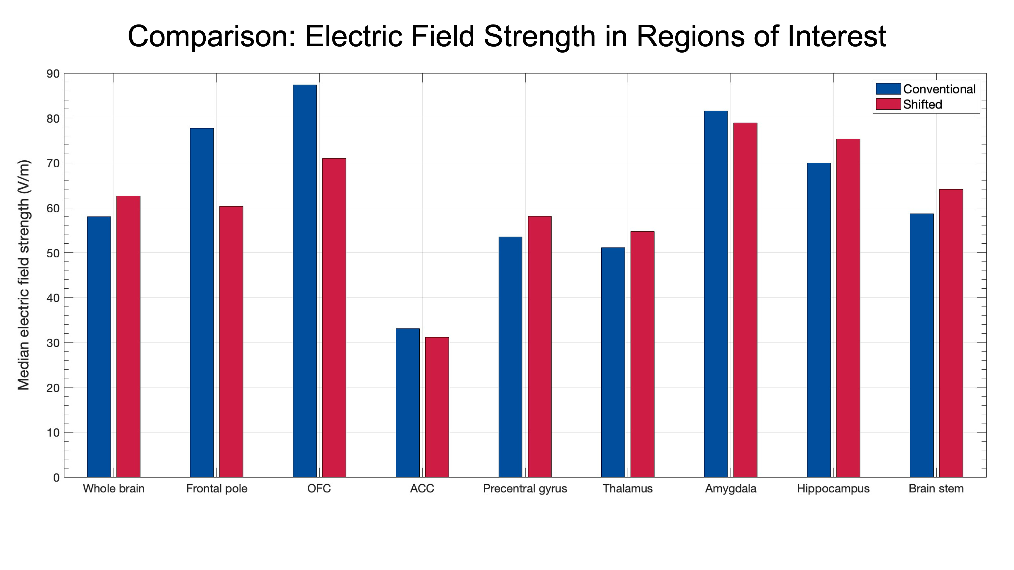 Comparison of electric field strengths in various regions of interest (ROIs) in the brain