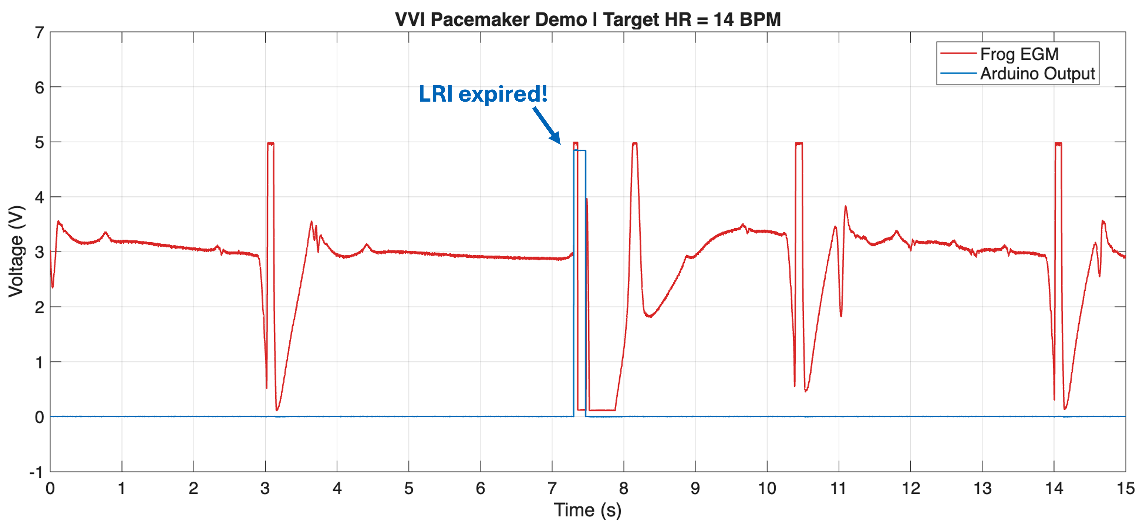 Arduino pacing pulse output with LRI and pulse width annotated