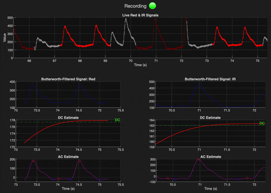 Pulse Oximeter